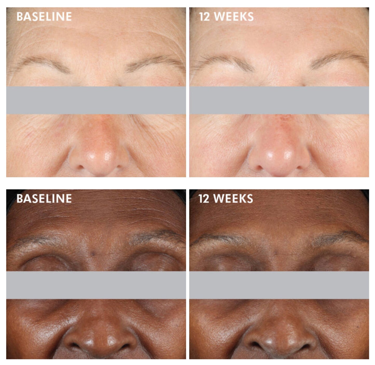 A.G.E. INTERRUPTER ADVANCED